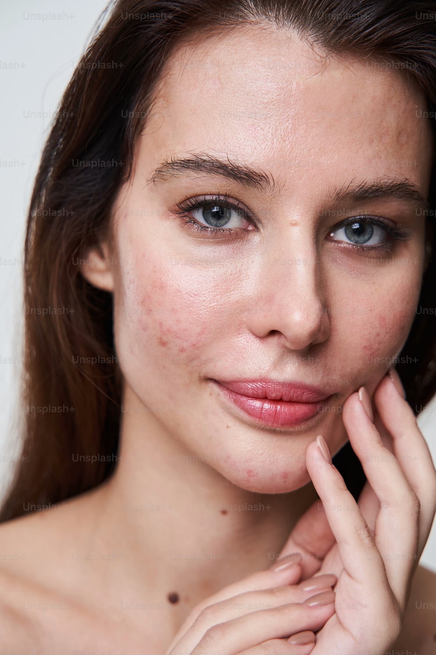 Why You're Breaking Out — and What Actually Helps